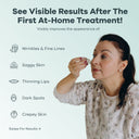 The Micro Infusion System™