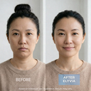 ELYVIA Micro-Infusion Kit™